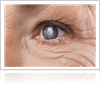 Important facts about Glaucoma by Gerstein Eye Institute in Chicago